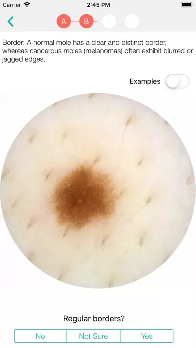 MoleScope™