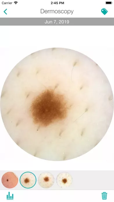 MoleScope™